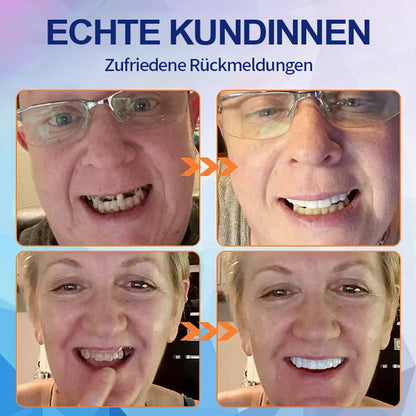 Hermsa® 🦷Fortschrittliches, individuelles Vollprothesen-Set🦷 (⏰Befristeter Rabatt für die letzten 30 Minuten⏰)