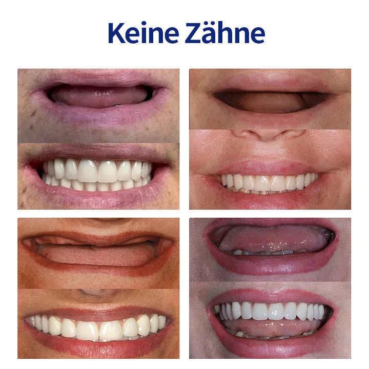Hermsa® 🦷Fortschrittliches, individuelles Vollprothesen-Set🦷 (⏰Befristeter Rabatt für die letzten 30 Minuten⏰)