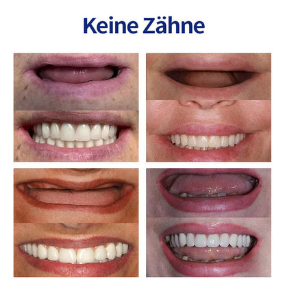 Hermsa® 🦷Fortschrittliches, individuelles Vollprothesen-Set🦷 (⏰Befristeter Rabatt für die letzten 30 Minuten⏰)