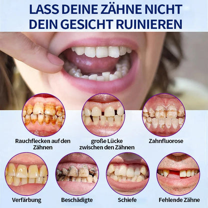Hermsa® 🦷Fortschrittliches, individuelles Vollprothesen-Set🦷 (⏰Befristeter Rabatt für die letzten 30 Minuten⏰)